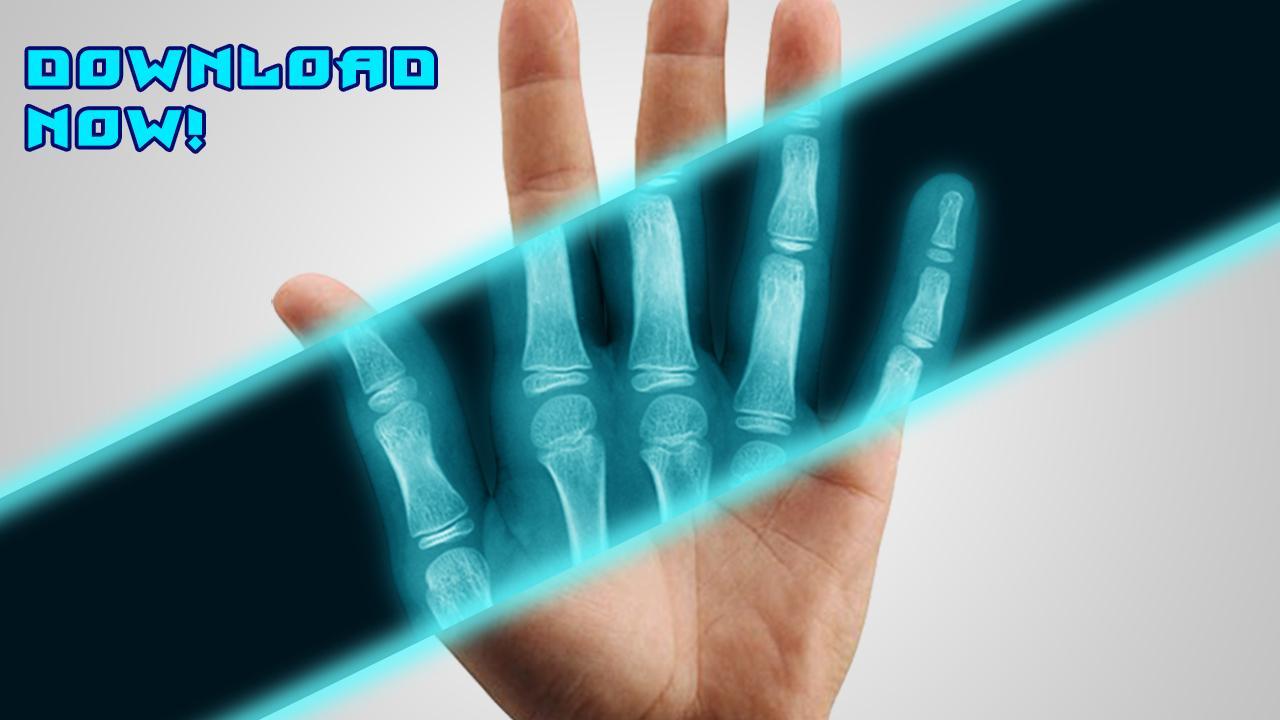 Best X-Ray FREE