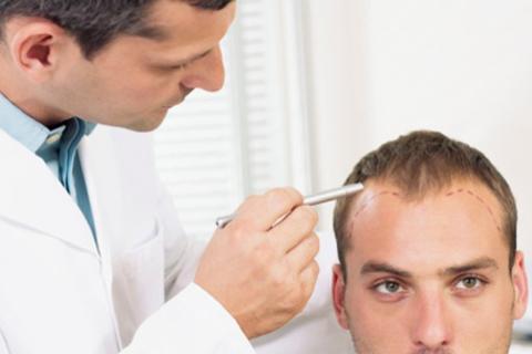 Hair Fall Control